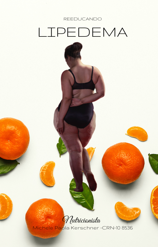 Lipedema